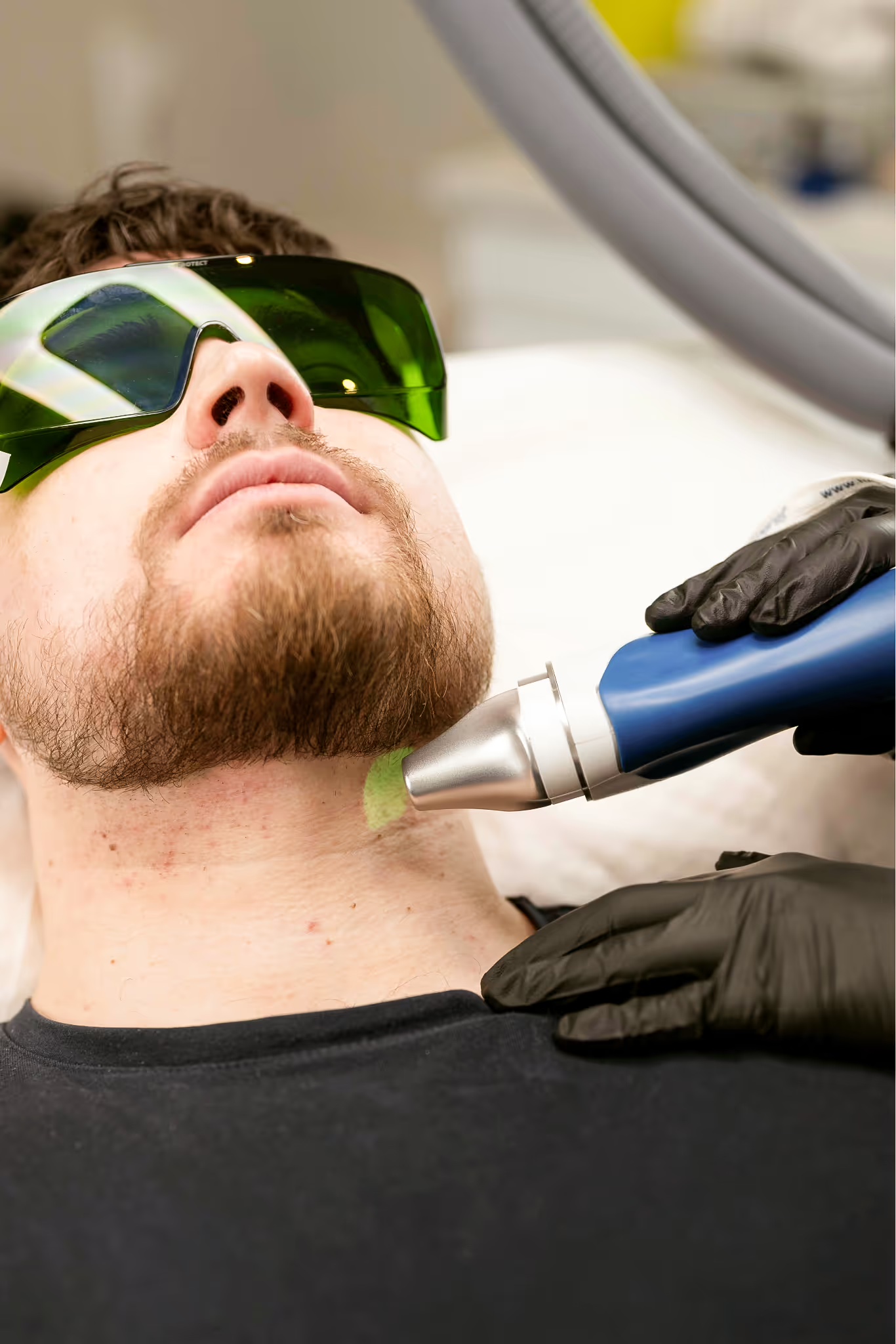 Laser hårfjerning på Self Care Clinic